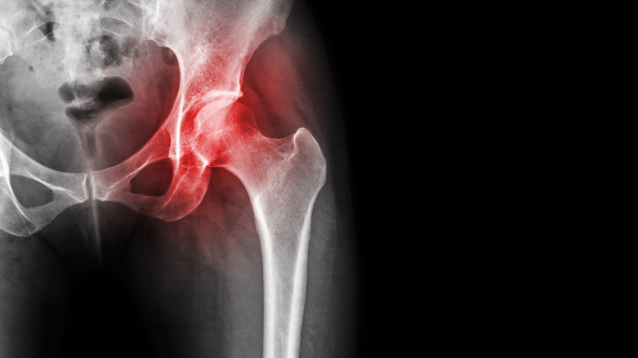 The Synergistic Power of Grounding, Red Light Therapy, and Methylene Blue: A Comprehensive Approach to Inflammation and Injury Healing