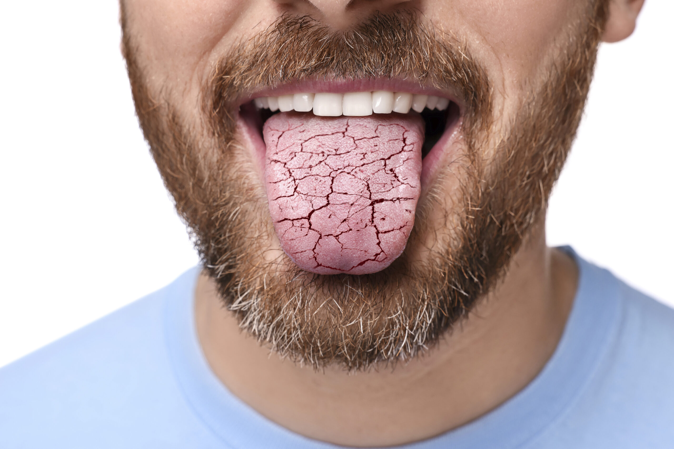 Dehydration: The Hidden Epidemic Affecting Your Health