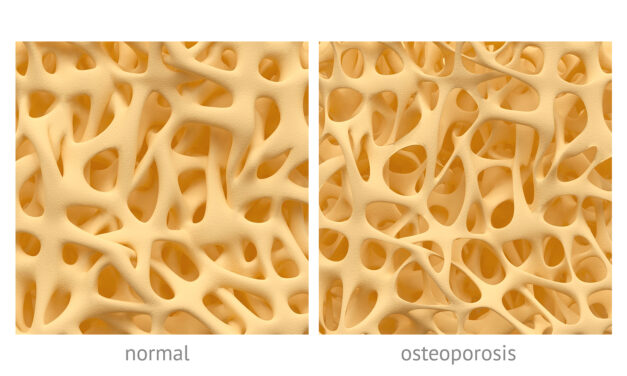 🦴 Natural Solutions for Bone Density and Joint Health